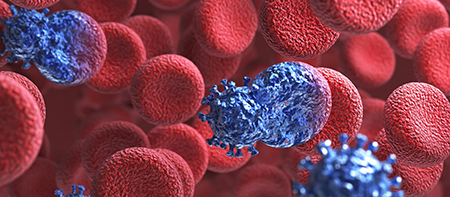 Αιματολογικός Καρκίνος Αιματολογικός Καρκίνος