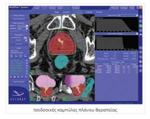 Ρομποτική Στερεοτακτική Ακτινοχειρουργική με CyberKnife Ρομποτική Στερεοτακτική Ακτινοχειρουργική με CyberKnife
